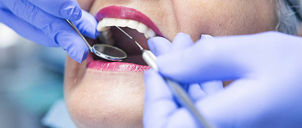 Best Broken or Chipped Tooth Repair in Lynn Haven, FL